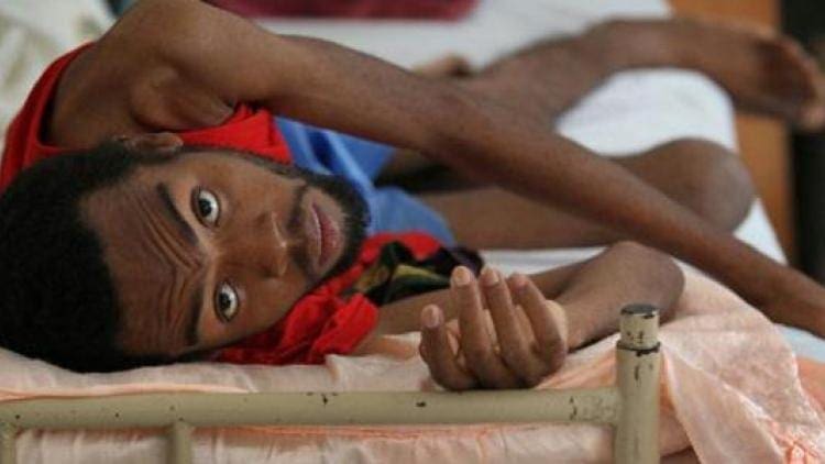 موريتانيا تبحث عن قادة لمحاربة « السل » بالأدوية