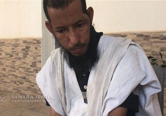 موريتانيا.. شاب مصاب بالصرع المزمن يطلب تدخل الرئيس